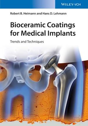 Bioceramic Coatings for Medical Implants