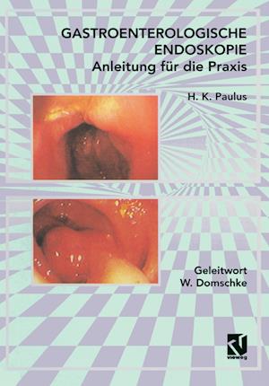 Gastroenterologische Endoskopie Anleitung Für Die Praxis