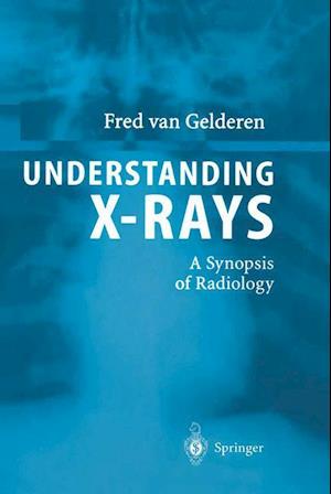 Understanding X-Rays