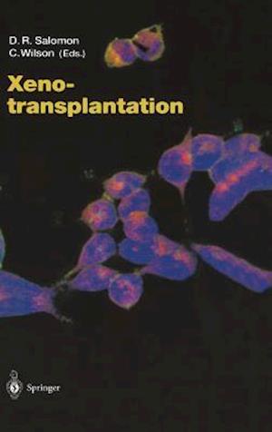 Xenotransplantation