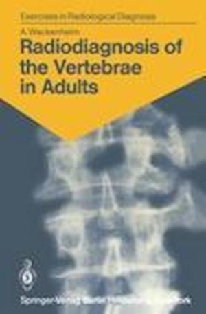 Radiodiagnosis of the Vertebrae in Adults
