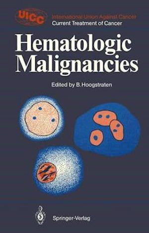 Hematologic Malignancies