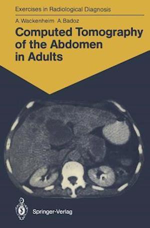 Computed Tomography of the Abdomen in Adults