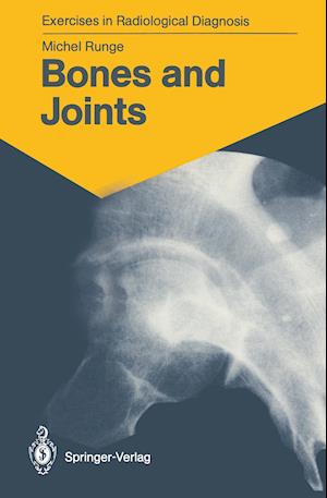 Bones and Joints