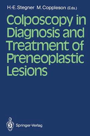 Colposcopy in Diagnosis and Treatment of Preneoplastic Lesions