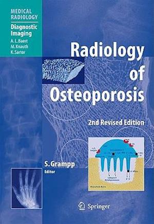 Radiology of Osteoporosis