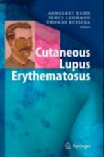 Cutaneous Lupus Erythematosus