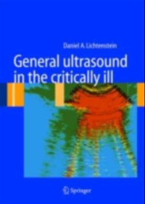 General ultrasound in the critically ill