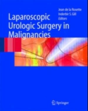 Laparoscopic Urologic Surgery in Malignancies