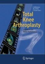 Total Knee Arthroplasty