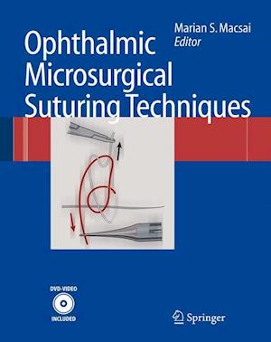 Ophthalmic Microsurgical Suturing Techniques