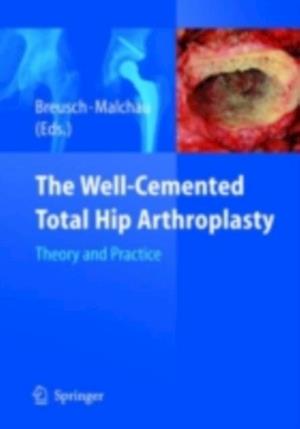 Well-Cemented Total Hip Arthroplasty
