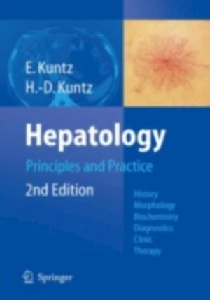 Hepatology, Principles and Practice