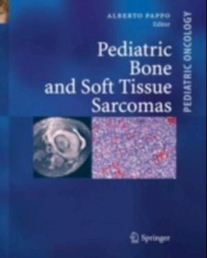 Pediatric Bone and Soft Tissue Sarcomas