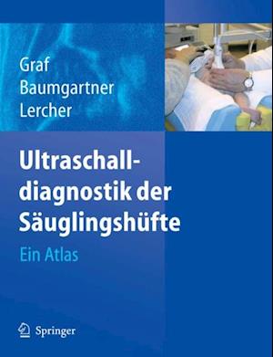 Ultraschalldiagnostik der Säuglingshüfte