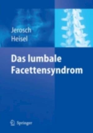 Das lumbale Facettensyndrom