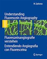 Understanding Fluorescein Angiography, Fluoreszeinangiografie verstehen, Entendiendo Angiografía con Fluoresceína