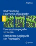 Understanding Fluorescein Angiography, Fluoreszeinangiografie verstehen, Entendiendo Angiografia con Fluoresceina