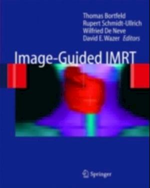 Image-Guided IMRT