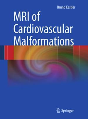 MRI of Cardiovascular Malformations