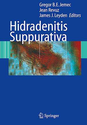 Hidradenitis Suppurativa