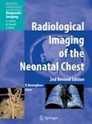 Radiological Imaging of the Neonatal Chest