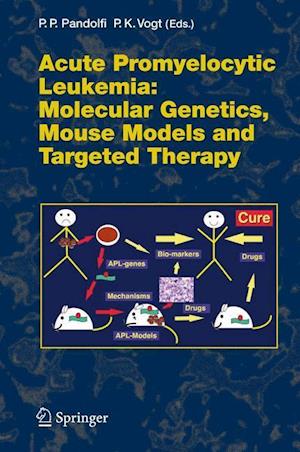 Acute Promyelitic Leukemia