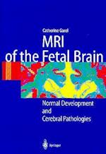 MRI of the Fetal Brain