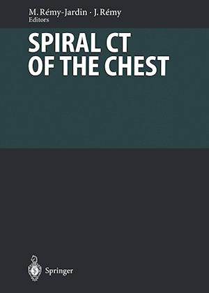 Spiral CT of the Chest