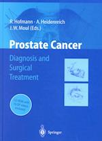 Prostate Cancer