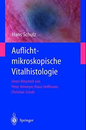 Auflichtmikroskopische Vitalhistologie