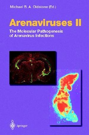 Arenaviruses