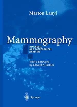 Mammography