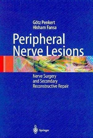 Peripheral Nerve Lesions