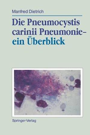 Die Pneumocystis carinii Pneumonie— ein Überblick
