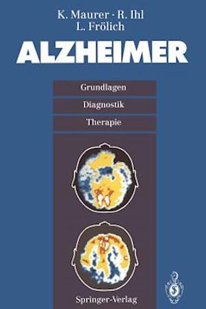 Alzheimer