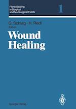 Fibrin Sealing in Surgical and Nonsurgical Fields