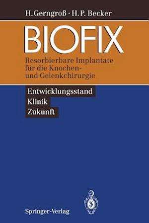 BIOFIX