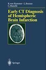 Early CT Diagnosis of Hemispheric Brain Infarction