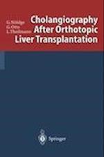 Cholangiography After Orthotopic Liver Transplantation