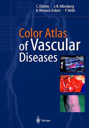 Color Atlas of Vascular Diseases