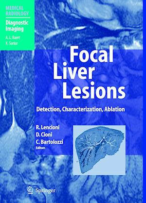 Focal Liver Lesions
