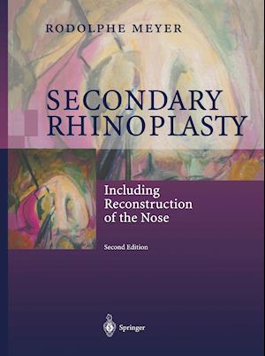 Secondary Rhinoplasty