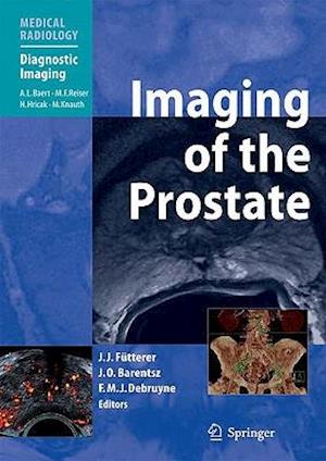 Imaging of the Prostate