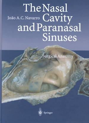 The Nasal Cavity and Paranasal Sinuses