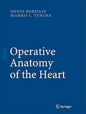 Operative Anatomy of the Heart