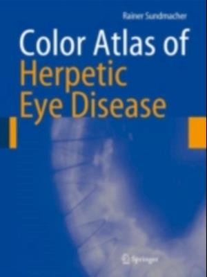 Color Atlas of Herpetic Eye Disease