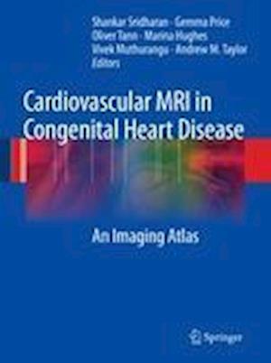 Cardiovascular MRI in Congenital Heart Disease