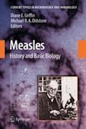 Measles