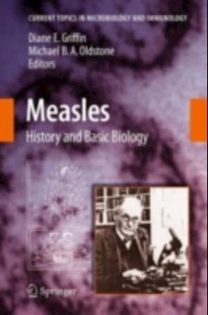 Measles